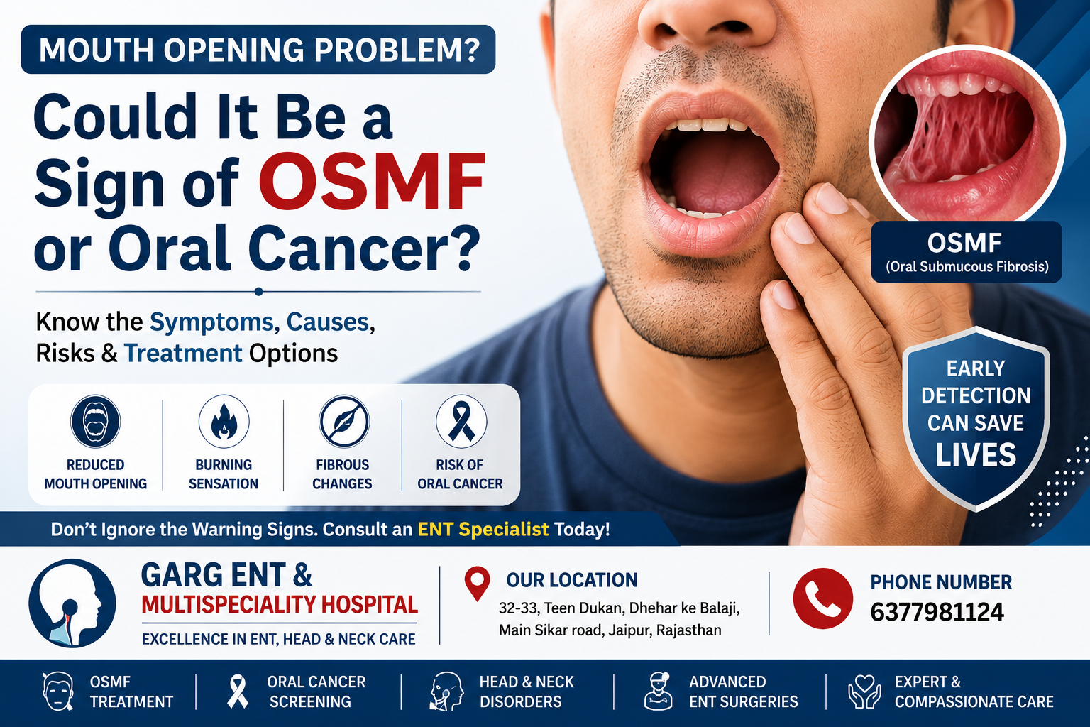 Mouth Opening Problem: Could It Be a Sign of OSMF or Oral Cancer?