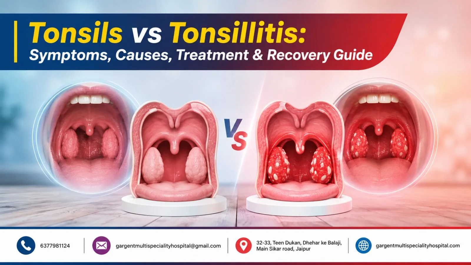 Tonsils vs Tonsillitis: Symptoms, Causes, Treatment & Recovery Guide