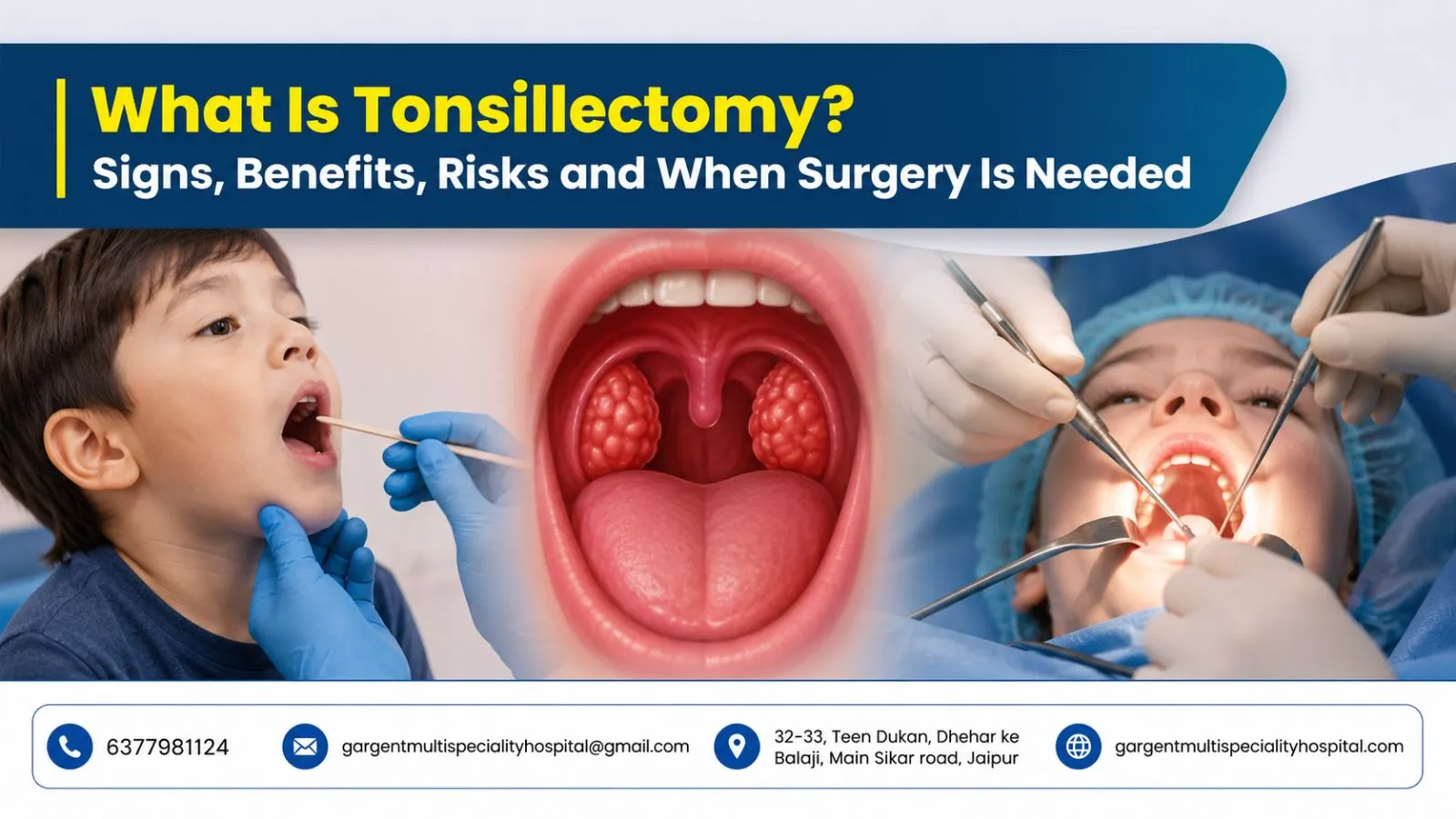 What Is Tonsillectomy? Signs, Benefits, Risks and When Surgery Is Needed